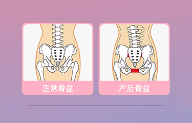 盆底肌修復(fù)儀器怎么樣？哪些人可以使用它呢