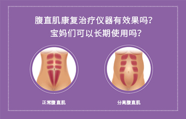 腹直肌康復(fù)治療儀器有效果嗎？寶媽們可以長期使用嗎？