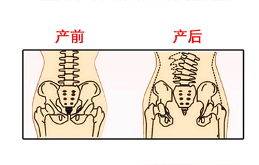 月子期間盆骨儀器修復(fù)時間有限制嗎？與手法修復(fù)相比哪個效果好？